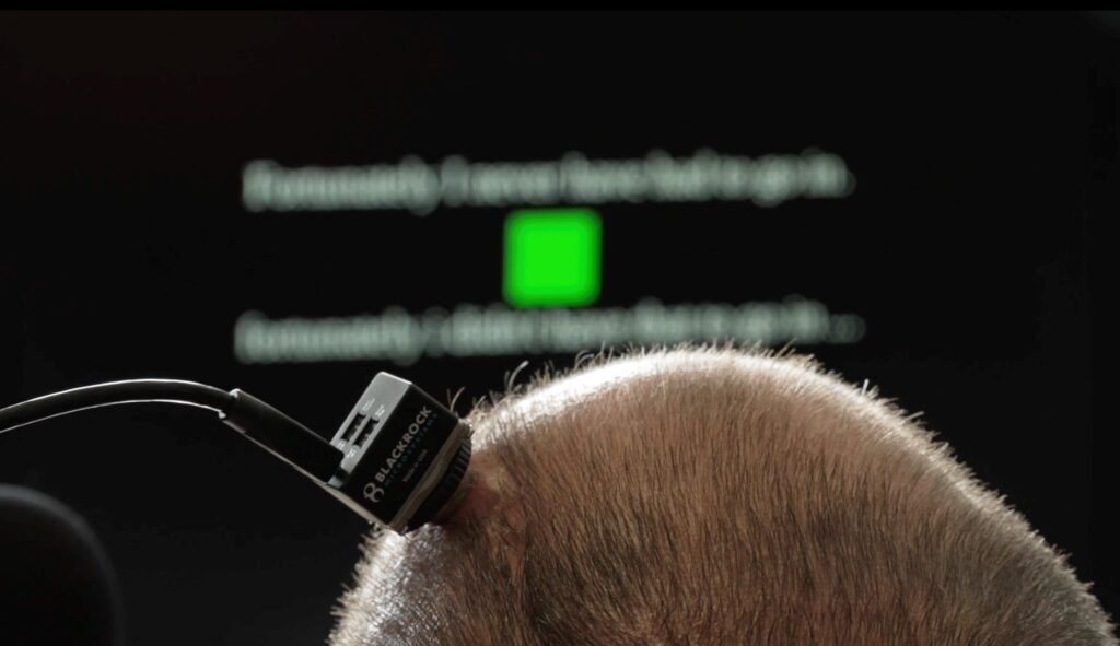 first-of-its-kind-tech-1024x591.jpg